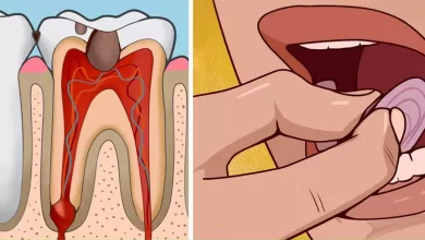 12 All Natural Toothache Remedies Your Dentist Doesn’t Want You to Know About 2025 | Tips & Tricks