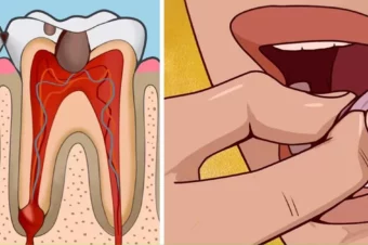 12 All Natural Toothache Remedies Your Dentist Doesn’t Want You to Know About