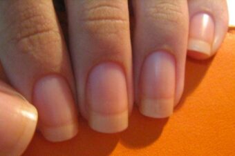 15 Cancer Signs Women Often Overlook!