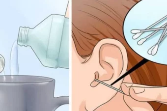 2-Ingredient Mixture To Effectively Help Eliminate Earwax And Ear Infections