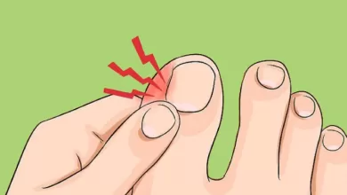 4 Remedies To Treat Ingrown Toe Nails At Home 2025 | Tips & Tricks