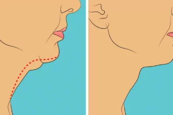 5 Exercises To Avoid Stubborn Double Chin