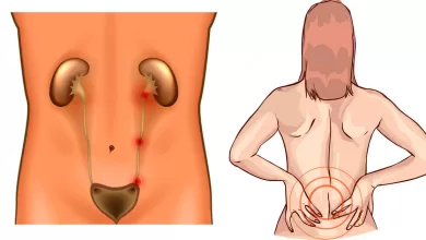 8 Signs That Your Anxiety, Sleep Problems, And Joint Pain Are Caused By Adrenal Fatigue 2025 | Tips & Tricks