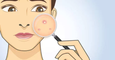 8 Surprising Alternative uses of Listerine