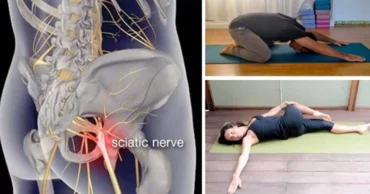 9 easy yoga positions to relieve sciatica pain in 16 mins or less