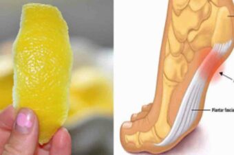 A Peel of Lemon Can Remove Joint Pain In No Time