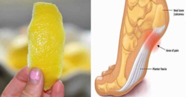 A Peel of Lemon Can Remove Joint Pain In No Time
