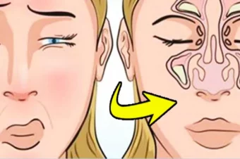 DIY: How To Clear Your Sinuses in Seconds Using Nothing but Your Fingers