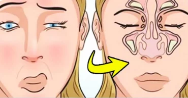 DIY: How To Clear Your Sinuses in Seconds Using Nothing but Your Fingers