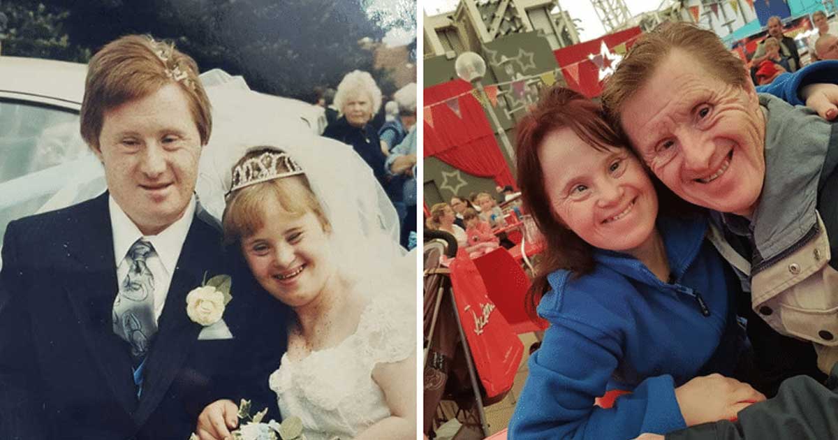Down Syndrome Couple Criticized By All Prove Skeptics Wrong By Celebrating 22 Years Of Love and A Blissful marriage