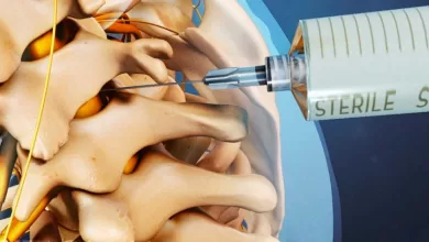 FDA Warns About Dangers of Epidural Steroid Injections for Back Pain 2025 | Tips & Tricks