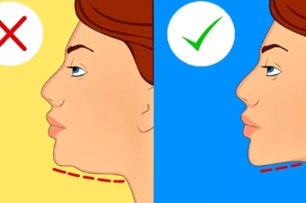How To Get Rid Of Neck Fat And Double Chin Fast Exercises And Home Remedies Tips