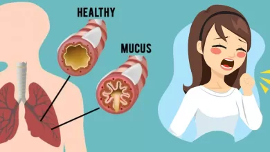 How to Get Rid of Phlegm and Mucus in Chest & Throat (Instant Result) 2025 | Tips & Tricks