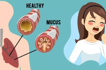 How to Get Rid of Phlegm and Mucus in Chest & Throat (Instant Result)