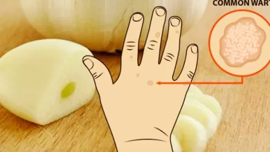 How to remove moles, warts, blackheads, skin tags, and age spots completely naturally 2025 | Tips & Tricks