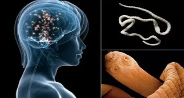 If You Are Eating This Common Food You Have BIG Chance To Get Brain Worms