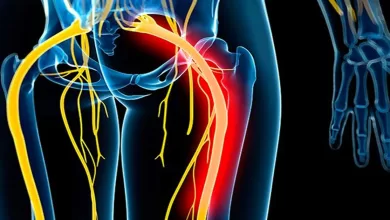 Press These Points: 18 Self-Help Tips For Sciatica That Truly Work 2025 | Tips & Tricks