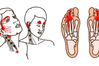 Signs Of Vitamin B12 Deficiency You Should Never Ignore
