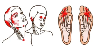 Signs Of Vitamin B12 Deficiency You Should Never Ignore