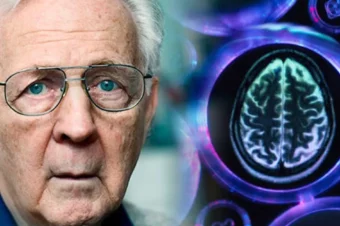 Stop Using These 20 Medications Because They Cause Memory Loss