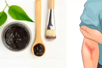 The Black Healing Salve That Amish People Have Used For Centuries to Treat Almost Any Skin Problem