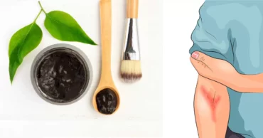 The Black Healing Salve That Amish People Have Used For Centuries to Treat Almost Any Skin Problem