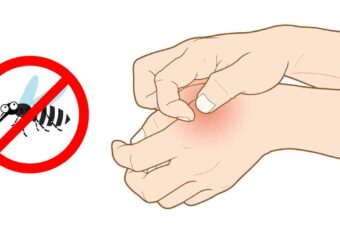 The Surprising Reasons Why Mosquitoes Bite Some People and Don’t Touch Others