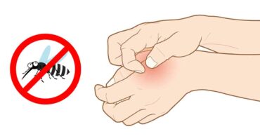 The Surprising Reasons Why Mosquitoes Bite Some People and Don’t Touch Others