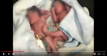 They Thought Puppies Were Crying Until They Looked In Bush And Saw Newborn Twins