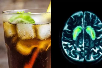 This is How Your Brain Can Physically Change After Drinking Soda For One Month