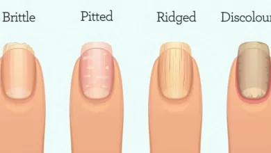 This Is What Your Fingernails Are Warning You About: Organ Failure, Inflammation, or Worse 2025 | Tips & Tricks