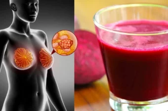 This Juice Cleanses Your Liver & Lowers High Blood Pressure!