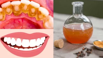 This Mouthwash Removes Plaque From Teeth In 2 Minutes 2025 | Tips & Tricks